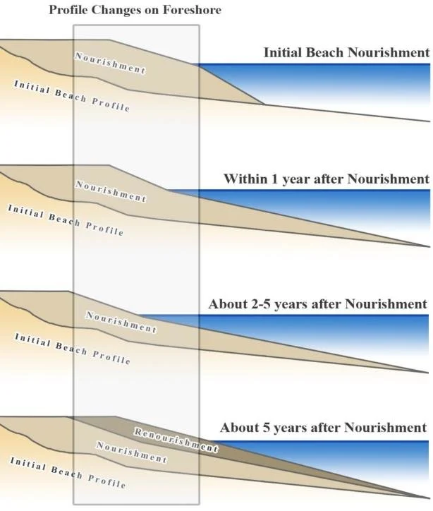 Beach profile changes: initial nourishment, within one year, after two to five years, and renourishment after about five years.